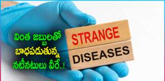Celebrities Who Suffering from Strange Diseases..!