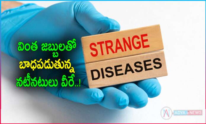 Celebrities Who Suffering from Strange Diseases..!