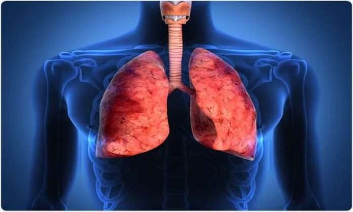 asthama