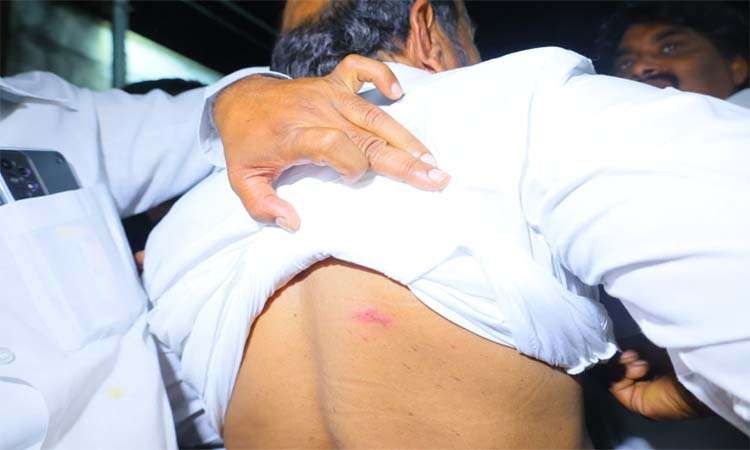 ఎంపీ ఆర్ కృష్ణయ్యపై దాడి