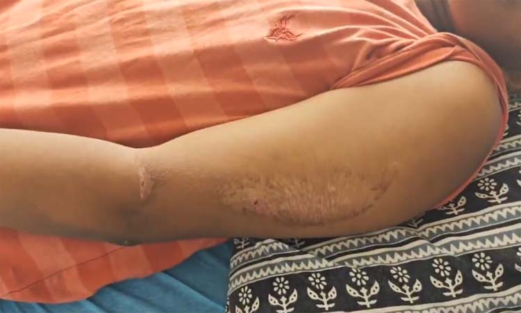 శ్రీచైతన్య హాస్టల్‌లో ర్యాగింగ్ భూతం..