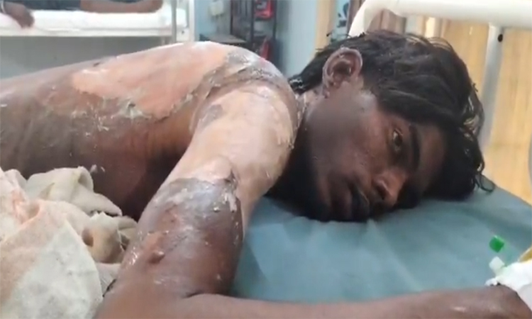 ప్రియురాలు ఇంటి ముందు ప్రియుడు ఆత్మహత్యాయత్నం!
